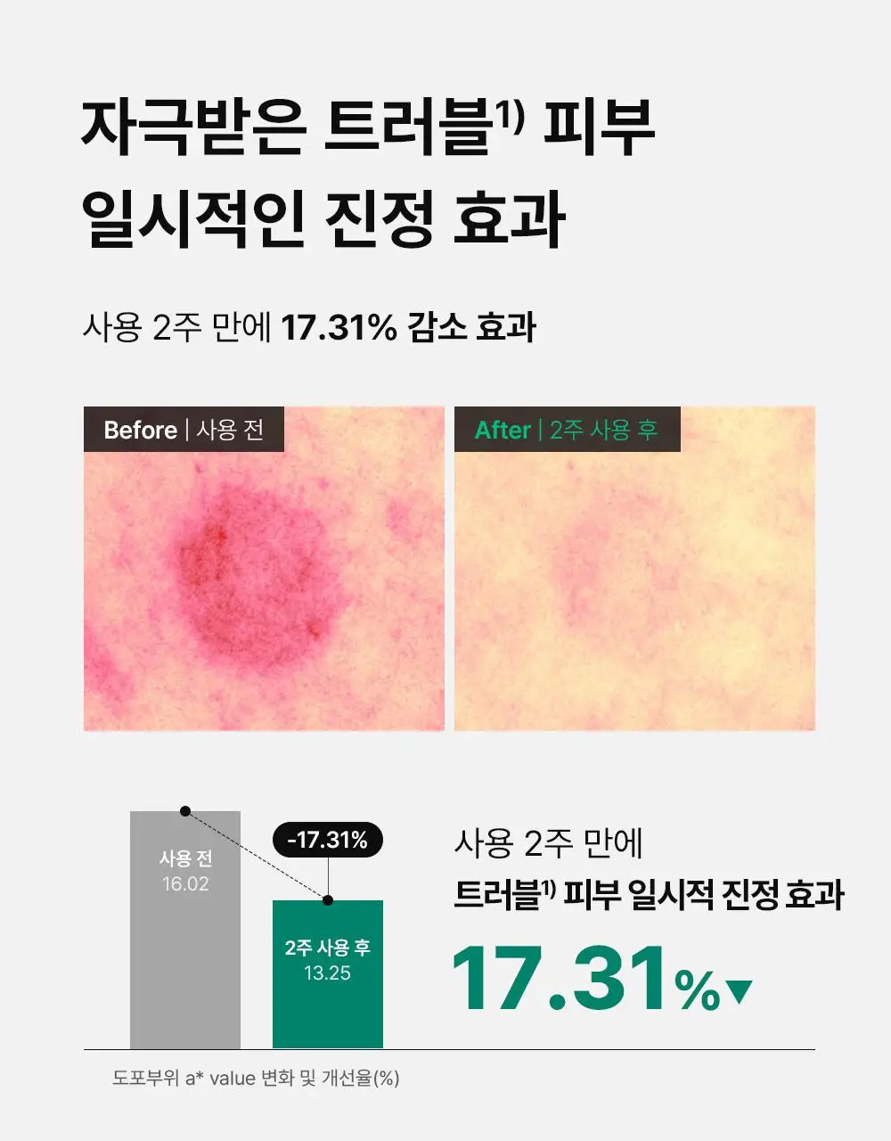 [단독기획] 동아제약 아크네 프로 겔제 30ml 기획(+3ml+크림제3ml) 상세페이지 11
